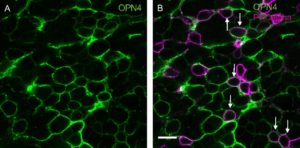 Imagen de parte de tejido celular retiniano visto a través de un microscopio, cuyo fondo es negro, y el entramado de red, o cadena que lo configura, es de color verde, todo ello en la imagen de la izquierda. La imagen de la derecha es de iguales características, si bien, la red es verde y por algunas zonas también morada, indicando la acción de la menalopsina.