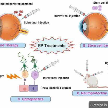 Diagrama ilustrativo de tratamientos para la Retinosis Pigmentaria (RP). En el centro, aparece el título "RP Treatments". Hay cuatro secciones, cada una con imágenes y texto descriptivo: A la izquierda arriba (A. Gene Therapy): Un ojo con una aguja aplicando una inyección subretiniana, mostrando el reemplazo de un gen mediado por vectores. A la derecha arriba (B. Stem cell treatment): Un ojo con una aguja administrando una inyección intravítrea, representando el tratamiento con células madre. Abajo a la izquierda (C. Optogenetics): Células nerviosas, luz y la administración de una proteína fotosensible a través de inyección intravítrea. Abajo a la derecha (D. Neuroprotective): Un ratón recibiendo una inyección que indica el uso de agentes neuroprotectores, como pequeñas moléculas o proteínas. Cada tratamiento tiene un título con color distintivo debajo de la imagen correspondiente.