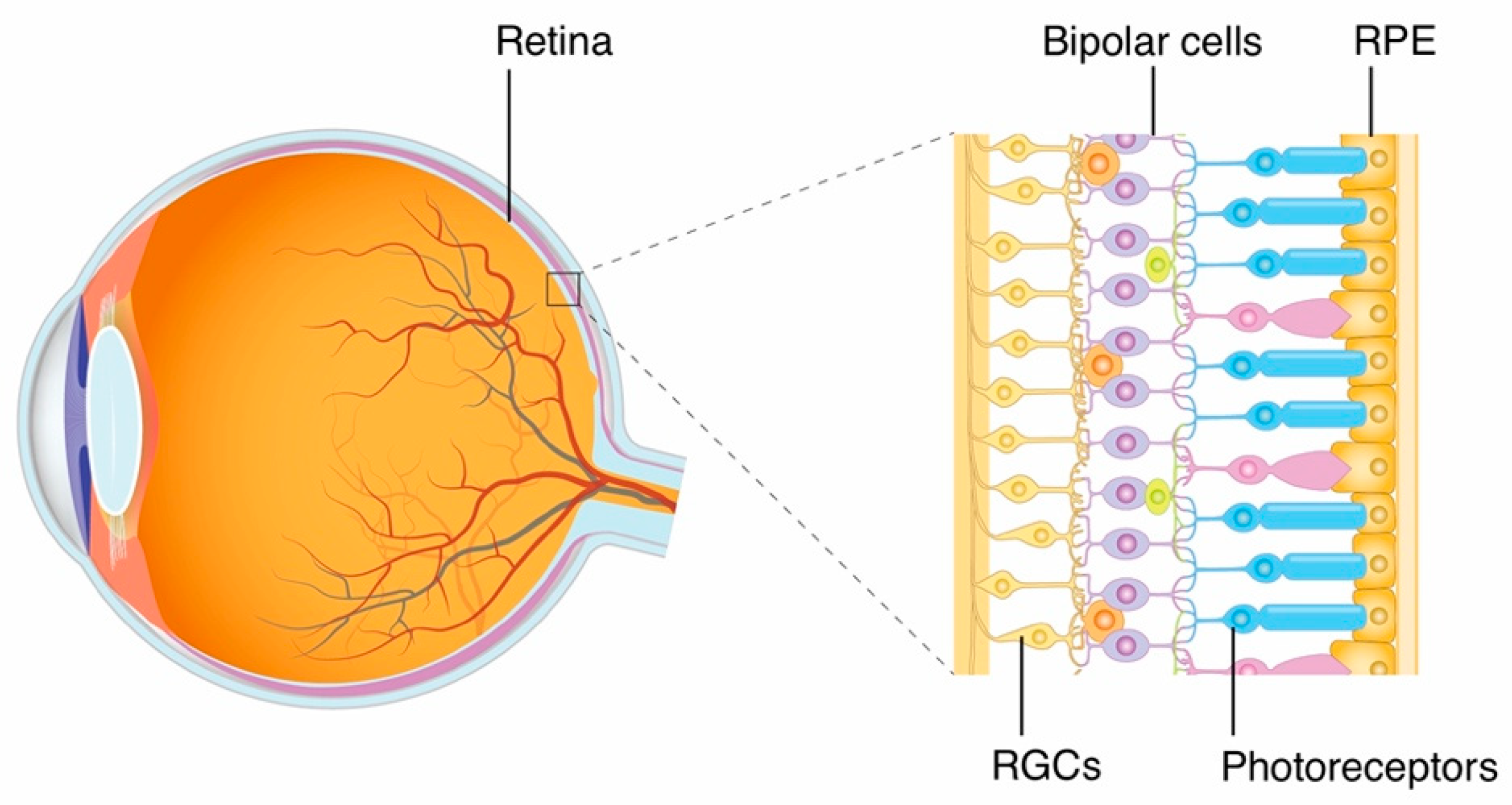 Diagrama anatómico del ojo humano, mostrando un corte transversal en el que se observa la retina y una ampliación de su estructura celular. En la ampliación, se distinguen varias capas celulares. Desde la derecha hacia la izquierda, se observan: - RPE (epitelio pigmentario retinal), identificado por las células más a la derecha y resaltadas en amarillo. - Fotoreceptores, indicados con la etiqueta "Photoreceptors", representados en azul y rosa, estos son los conos y bastones encargados de captar la luz. - Células bipolares ("Bipolar cells"), mostradas en color morado, situadas en la capa intermedia. - Células ganglionares de la retina ("RGCs"), señaladas en amarillo claro, a la izquierda de las células bipolares. El gráfico resalta cómo estas capas celulares están organizadas dentro de la retina y cómo participan en el procesamiento inicial de la información visual.